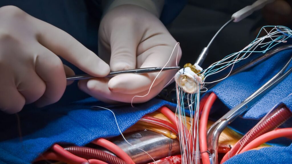 WhatsApp-Image-2022-04-12-at-12.19.32-1-1024x576